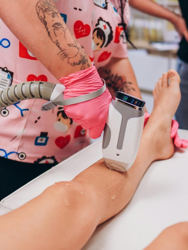 Épilation laser : une solution durable et confortable